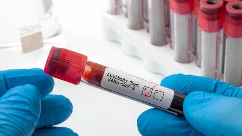 1356 са новите случаи на коронавирус у нас за последните